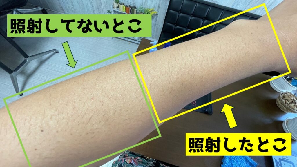 照射したところと照射していないところの比較