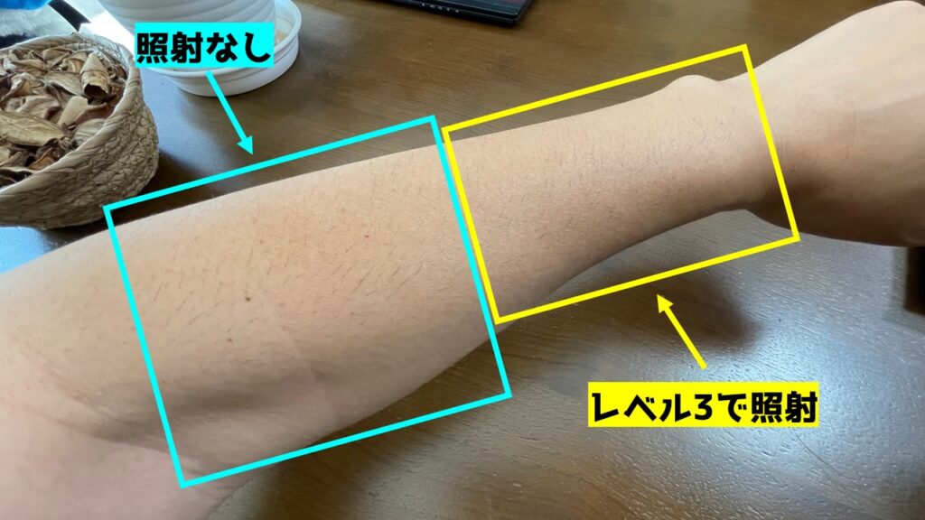 1週間後の腕の様子