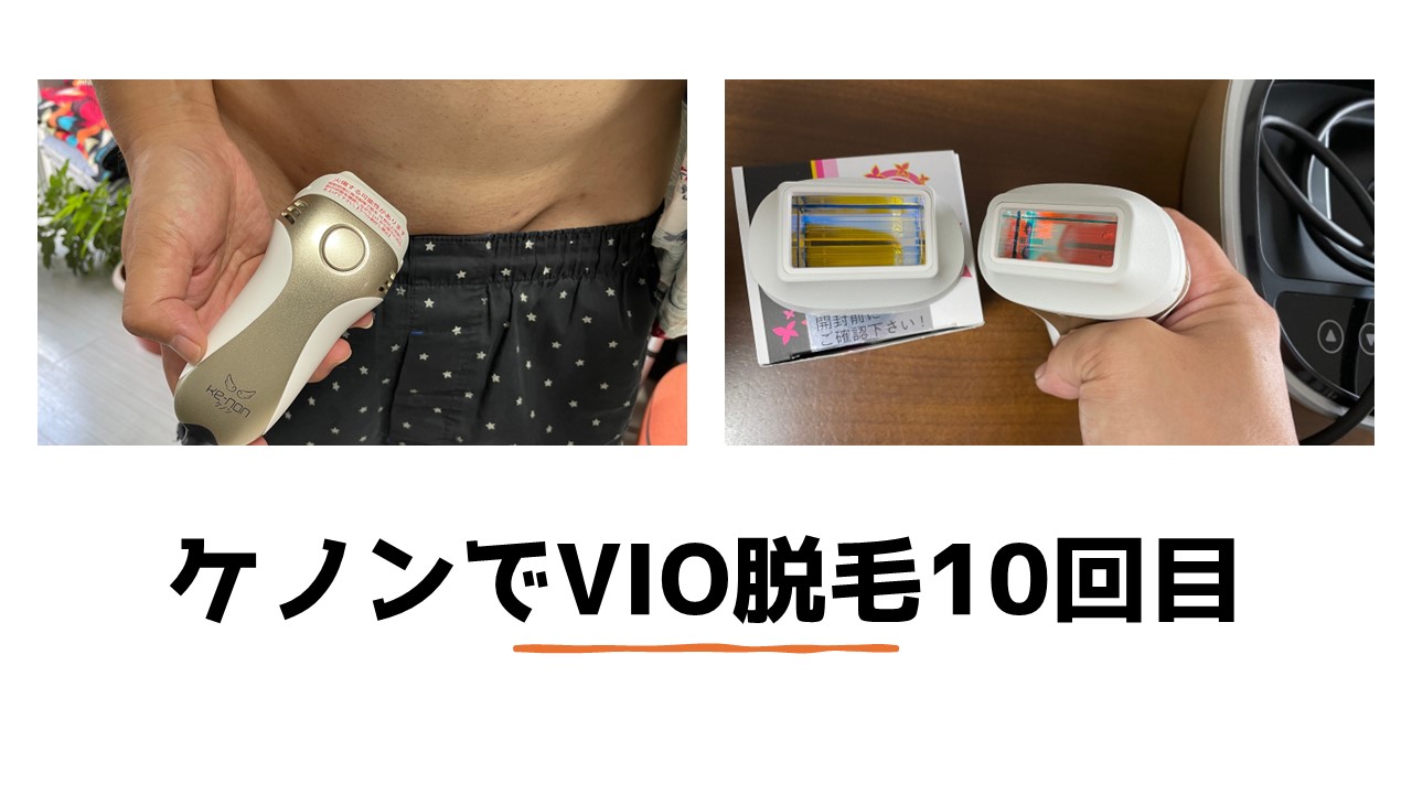 ケノンでVIO脱毛10回目の照射｜色素の濃い竿の裏とか玉袋はどうする 