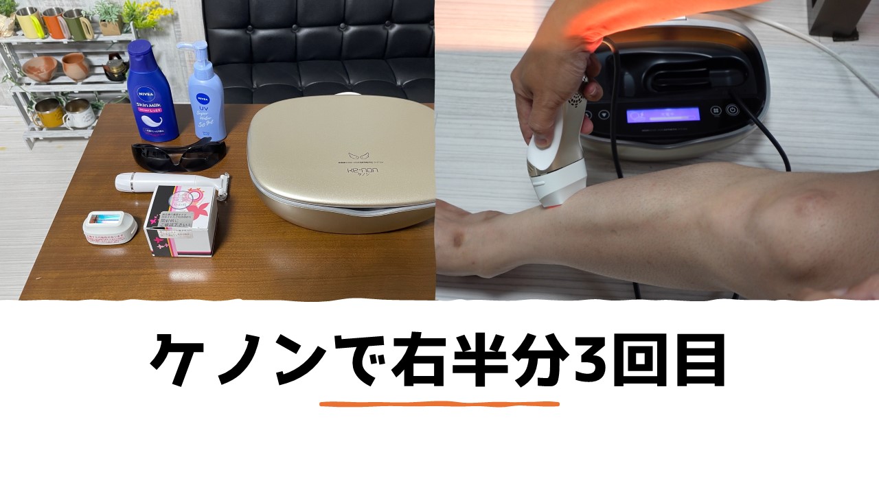 ケノンで脱毛！レベル7の連続モードにしたら急に遅くなりました 