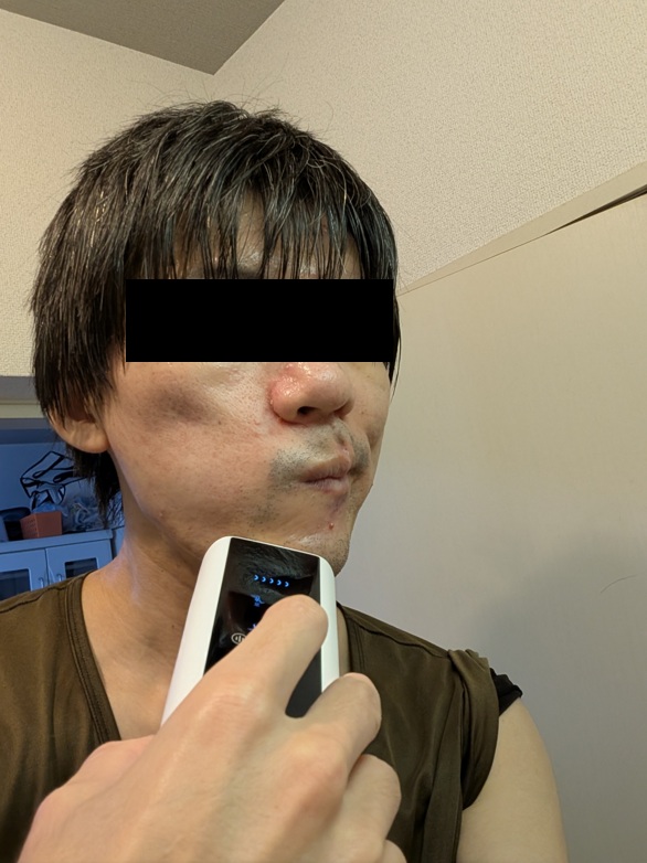 YOYIFUNで顔の脱毛