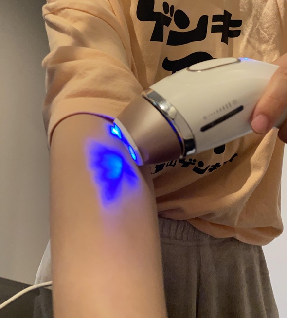 シルクエキスパートで腕の脱毛