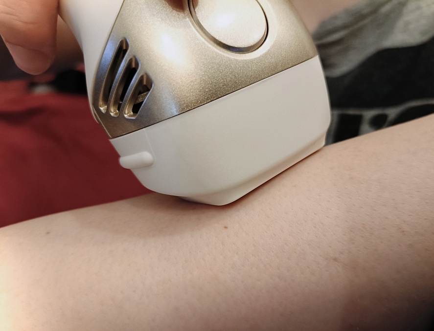ケノンで腕の照射