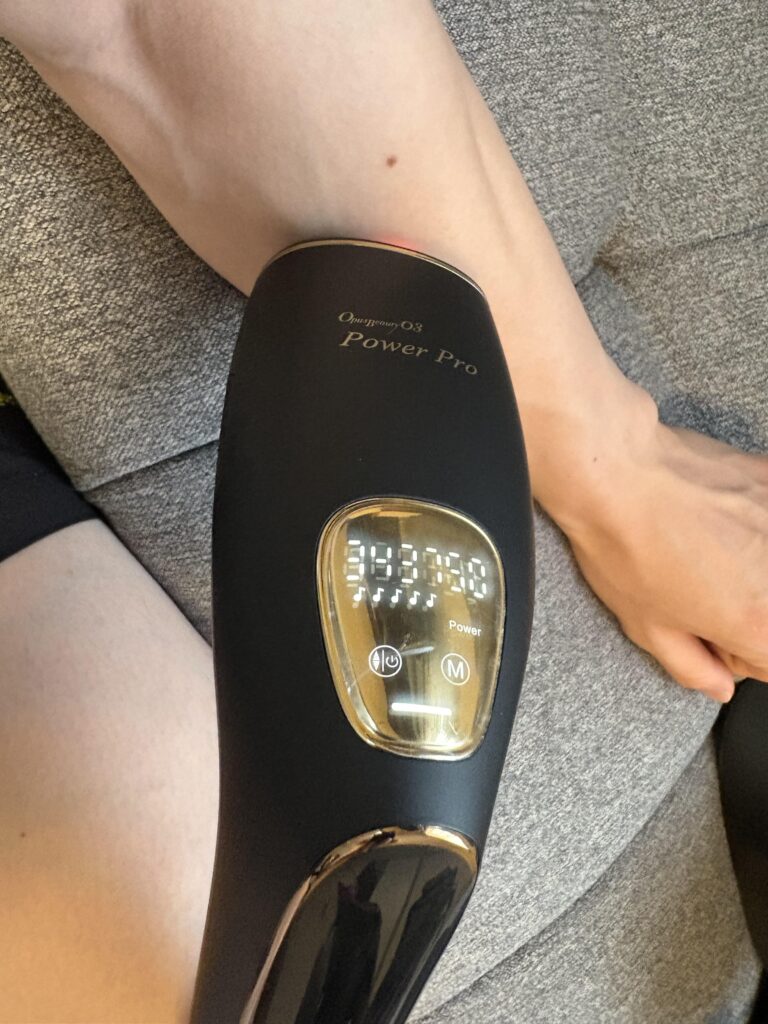 OPUS BEAUTY03で腕の脱毛